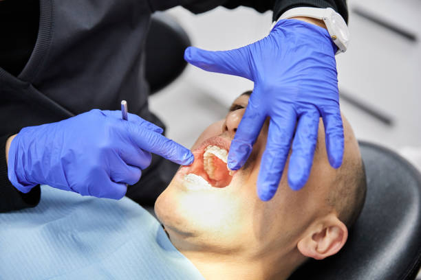 Best Emergency Dental Care for Sports Injuries in Parker, SC