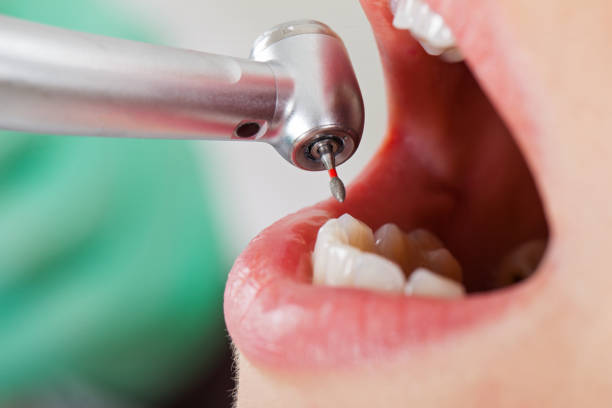 Best Emergency Treatment for Oral Infections in Parker, SC